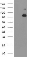 ACSS2 / ACAS2 Antibody - HEK293T cells were transfected with the pCMV6-ENTRY control (Left lane) or pCMV6-ENTRY ACSS2 (Right lane) cDNA for 48 hrs and lysed. Equivalent amounts of cell lysates (5 ug per lane) were separated by SDS-PAGE and immunoblotted with anti-ACSS2.