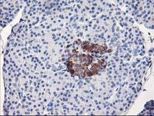 ACSS2 / ACAS2 Antibody - IHC of paraffin-embedded Human pancreas tissue using anti-ACSS2 mouse monoclonal antibody. (Heat-induced epitope retrieval by 10mM citric buffer, pH6.0, 100C for 10min).