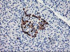 ACSS2 / ACAS2 Antibody - IHC of paraffin-embedded Human pancreas tissue using anti-ACSS2 mouse monoclonal antibody. (Heat-induced epitope retrieval by 10mM citric buffer, pH6.0, 100C for 10min).