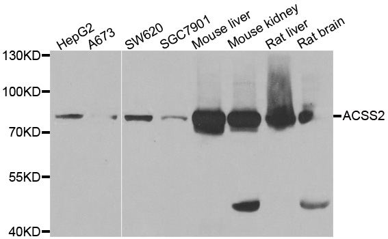ACSS2 / ACAS2 Antibody - Western blot analysis of extracts of various cell lines.