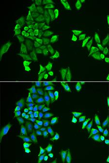 ACSS2 / ACAS2 Antibody - Immunofluorescence analysis of HeLa cells.