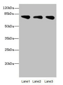 ACSS2 / ACAS2 Antibody - Western blot All Lanes: ACSS2antibody at 2.14ug/ml Lane 1 : Mouse liver tissue Lane 2 : Mouse kidney tissue Lane 3 : U87 whole cell lysate Secondary Goat polyclonal to Rabbit IgG at 1/10000 dilution Predicted band size: 79,81 kDa Observed band size: 79 kDa