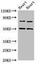 ACSS2 / ACAS2 Antibody - Western Blot Positive WB detected in:Rat heart tissue,Mouse heart tissue All Lanes:Acss2 antibody at 4µg/ml Secondary Goat polyclonal to rabbit IgG at 1/50000 dilution Predicted band size: 79 KDa Observed band size: 79,50 KDa
