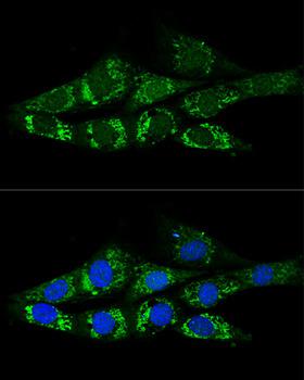 ACSS2 / ACAS2 Antibody - Confocal immunofluorescence analysis of NIH/3T3 cells using ACSS2 Polyclonal Antibody at dilution of 1:200.Blue: DAPI for nuclear staining.