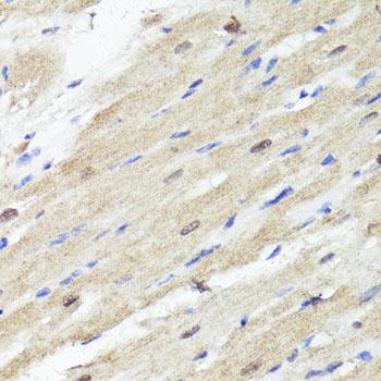 ACSS2 / ACAS2 Antibody - Immunohistochemistry of paraffin-embedded Rat heart using ACSS2 Polyclonal Antibody at dilution of 1:100 (40x lens).