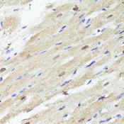 ACSS2 / ACAS2 Antibody - Immunohistochemistry of paraffin-embedded Rat heart using ACSS2 Polyclonal Antibody at dilution of 1:100 (40x lens).