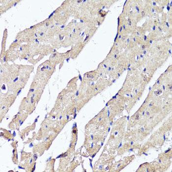 ACSS2 / ACAS2 Antibody - Immunohistochemistry of paraffin-embedded Mouse heart using ACSS2 Polyclonal Antibody at dilution of 1:100 (40x lens).
