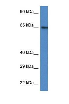 ACSS2 / ACAS2 Antibody - ACSS2 antibody Western blot of HT1080 Cell lysate. Antibody concentration 1 ug/ml.  This image was taken for the unconjugated form of this product. Other forms have not been tested.