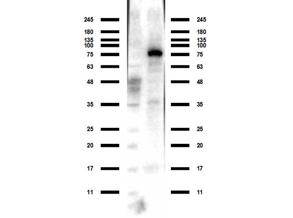 ACSS2 / ACAS2 Antibody - Western Blot of rabbit anti-ACSS2 antibody. Lane 1: MW ladder (opal pre-stained). Lane 2: HEPG2 WCL. Load: 10 ug per lane. Primary antibody: ACSS2 antibody at 1:1000 for overnight at 4°C. Secondary antibody: rabbit secondary HRP antibody at 1:70,000 for 30 min at RT. Block: BlockOut 30 min at RT. Predicted/Observed size: Expect 76 kDa for ACSS2 protein.