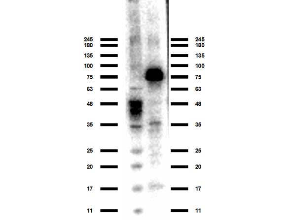 ACSS2 / ACAS2 Antibody - Western Blot of rabbit anti-ACSS2 antibody. Lane 1: MW ladder (opal pre-stained). Lane 2: HEPG2 WCL. Load: 10 ug per lane. Primary antibody: ACSS2 antibody at 1:1000 for overnight at 4°C. Secondary antibody: rabbit secondary HRP antibody at 1:70,000 for 30 min at RT. Block: BlockOut 30 min at RT. Predicted/Observed size: expect 76 kDa for ACSS2 protein.