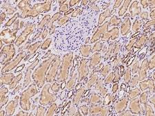 ACSS3 Antibody - Immunochemical staining of human ACSS3 in human kidney with rabbit polyclonal antibody at 1:100 dilution, formalin-fixed paraffin embedded sections.