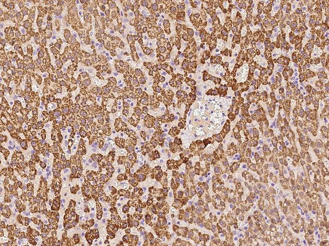 ACSS3 Antibody - Immunochemical staining of human ACSS3 in human liver with rabbit polyclonal antibody at 1:100 dilution, formalin-fixed paraffin embedded sections.