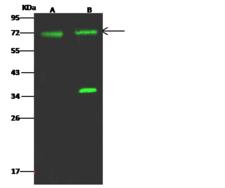ACSS3 Antibody - Anti-ACSS3 rabbit polyclonal antibody at 1:500 dilution. Lane A: HepG2 Whole Cell Lysate. Lane B: MCF7 Whole Cell Lysate. Lysates/proteins at 30 ug per lane. Secondary: Goat Anti-Rabbit IgG H&L (Dylight 800) at 1/10000 dilution. Developed using the Odyssey technique. Performed under reducing conditions. Predicted band size: 75 kDa. Observed band size: 72 kDa. (We are unsure as to the identity of these extra bands.)