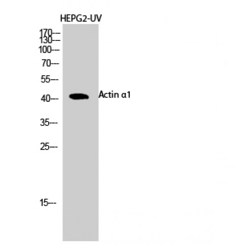 ACTA1 / Skeletal Muscle Actin Antibody - Western blot of Actin alpha1 antibody