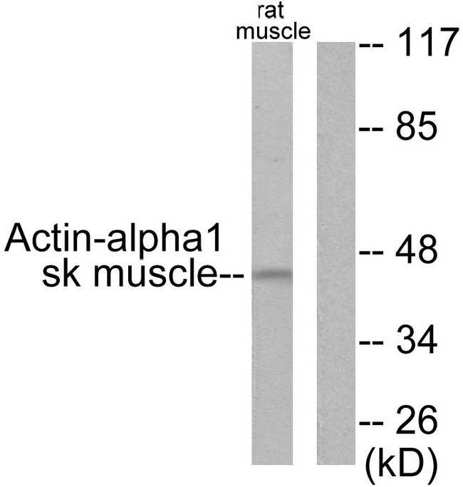 ACTA1 / Skeletal Muscle Actin Antibody - Western blot analysis of lysates from rat muscle cells, using Actin-alpha-1 Antibody. The lane on the right is blocked with the synthesized peptide.