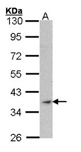 ACTA1 / Skeletal Muscle Actin Antibody - Sample (30 ug of whole cell lysate). A: Raji. 10% SDS PAGE. ASMA / ACTA1 antibody diluted at 1:1000.