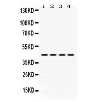 ACTA1 / Skeletal Muscle Actin Antibody - Actin antibody Western blot. All lanes: Anti Actin at 0.5 ug/ml. Lane 1: Rat Spleen Tissue Lysate at 50 ug. Lane 2: Mouse Spleen Tissue Lysate at 50 ug. Lane 3: HELA Whole Cell Lysate at 40 ug. Lane 4: MCF-7 Whole Cell Lysate at 40 ug. Predicted band size: 42 kD. Observed band size: 42 kD.