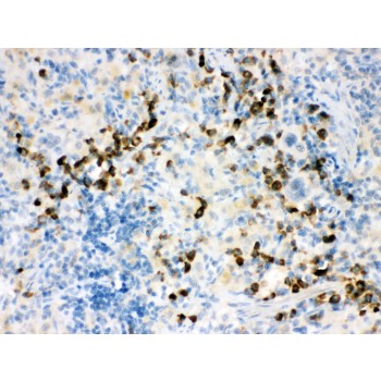 ACTA1 / Skeletal Muscle Actin Antibody - ACTIN antibody IHC-paraffin. IHC(P): Rat Spleen Tissue.