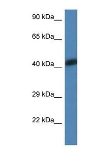 ACTA1 / Skeletal Muscle Actin Antibody - ACTA1 / ASMA antibody Western blot of 1 Cell lysate. Antibody concentration 1 ug/ml.  This image was taken for the unconjugated form of this product. Other forms have not been tested.