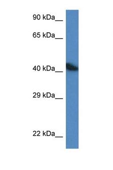 ACTA1 / Skeletal Muscle Actin Antibody - ACTA1 / ASMA antibody Western blot of A549 Cell lysate. Antibody concentration 1 ug/ml.  This image was taken for the unconjugated form of this product. Other forms have not been tested.