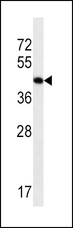 ACTA1 / Skeletal Muscle Actin Antibody - ACTA1 Antibody western blot of CEM cell line lysates (35 ug/lane). The ACTA1 antibody detected the ACTA1 protein (arrow).