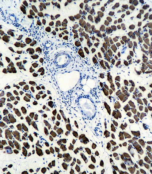 ACTA1 / Skeletal Muscle Actin Antibody - ACTA1 Antibody immunohistochemistry of formalin-fixed and paraffin-embedded human skeletal muscle followed by peroxidase-conjugated secondary antibody and DAB staining.