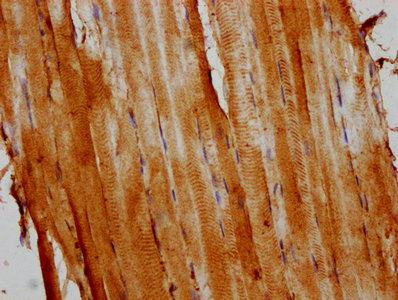 ACTA1 / Skeletal Muscle Actin Antibody - IHC image of ACTA1 Antibody diluted at 1:400 and staining in paraffin-embedded human skeletal muscle tissue performed on a Leica BondTM system. After dewaxing and hydration, antigen retrieval was mediated by high pressure in a citrate buffer (pH 6.0). Section was blocked with 10% normal goat serum 30min at RT. Then primary antibody (1% BSA) was incubated at 4°C overnight. The primary is detected by a biotinylated secondary antibody and visualized using an HRP conjugated SP system.