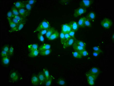 ACTA1 / Skeletal Muscle Actin Antibody - Immunofluorescence staining of HepG2 cells with ACTA1 Antibody at 1:133, counter-stained with DAPI. The cells were fixed in 4% formaldehyde, permeabilized using 0.2% Triton X-100 and blocked in 10% normal Goat Serum. The cells were then incubated with the antibody overnight at 4°C. The secondary antibody was Alexa Fluor 488-congugated AffiniPure Goat Anti-Rabbit IgG(H+L).