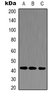 ACTA1 / Skeletal Muscle Actin Antibody - Western blot analysis of Alpha-actin-1 expression in HeLa (A); NIH3T3 (B); rat kidney (C) whole cell lysates.