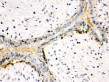 ACTA1 / Skeletal Muscle Actin Antibody