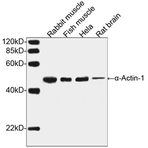 ACTA1 / Skeletal Muscle Actin Antibody - Western blot of tissue and cell lysates using alpha-Actin-1 Antibody, pAb, Rabbit (a-Actin-1 Antibody, pAb, Rabbit, 1 ug/ml) The signal was developed with with One-Step Western Complete Kit (Rabbit) Predicted Size: 42 kD Observed Size: 42 kD