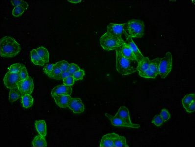 ACTA1 / Skeletal Muscle Actin Antibody - Immunofluorescence staining of HepG2 cells diluted at 1:60,counter-stained with DAPI. The cells were fixed in 4% formaldehyde, permeabilized using 0.2% Triton X-100 and blocked in 10% normal Goat Serum. The cells were then incubated with the antibody overnight at 4°C.The Secondary antibody was Alexa Fluor 488-congugated AffiniPure Goat Anti-Rabbit IgG (H+L).