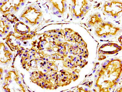 ACTA1 / Skeletal Muscle Actin Antibody - Immunohistochemistry Dilution at 1:100 and staining in paraffin-embedded human kidney tissue performed on a Leica BondTM system. After dewaxing and hydration, antigen retrieval was mediated by high pressure in a citrate buffer (pH 6.0). Section was blocked with 10% normal Goat serum 30min at RT. Then primary antibody (1% BSA) was incubated at 4°C overnight. The primary is detected by a biotinylated Secondary antibody and visualized using an HRP conjugated SP system.