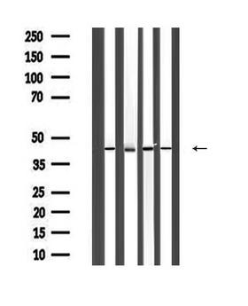 ACTA1 / Skeletal Muscle Actin Antibody - Western blot analysis of extracts of mouse tissue sample using Actin a 1 antibody.