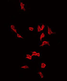 ACTA1 / Skeletal Muscle Actin Antibody - Staining LOVO cells by IF/ICC. The samples were fixed with PFA and permeabilized in 0.1% Triton X-100, then blocked in 10% serum for 45 min at 25°C. The primary antibody was diluted at 1:200 and incubated with the sample for 1 hour at 37°C. An Alexa Fluor 594 conjugated goat anti-rabbit IgG (H+L) Ab, diluted at 1/600, was used as the secondary antibody.