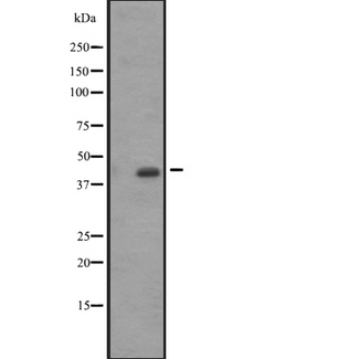 ACTA1 / Skeletal Muscle Actin Antibody - Western blot analysis of ACTA1/A2/C1 expression in A431 whole cells lysate. The lane on the left is treated with the antigen-specific peptide.