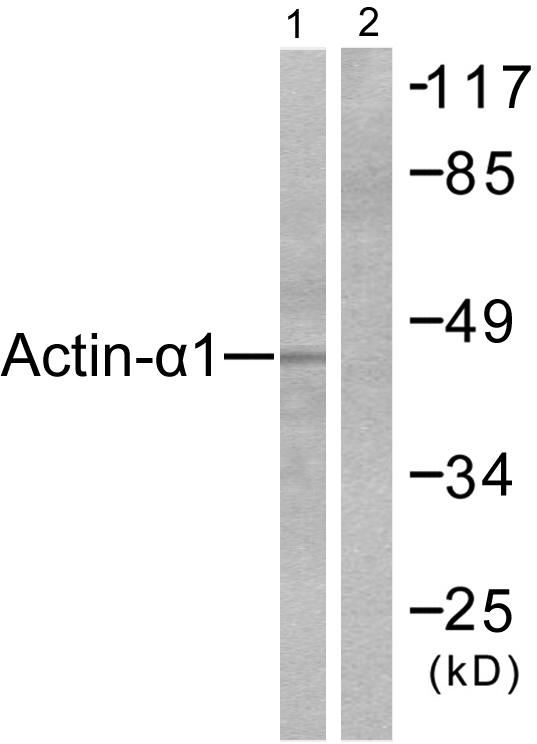 ACTA1 / Skeletal Muscle Actin Antibody - Western blot analysis of extracts from LOVO cells, using Actin-a-1 antibody.