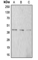 ACTA1 / Skeletal Muscle Actin Antibody - Western blot analysis of Alpha-actin-1 expression in A549 (A); SP2/0 (B); rat kidney (C) whole cell lysates.
