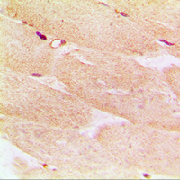 ACTA1 / Skeletal Muscle Actin Antibody - Immunohistochemical analysis of Alpha-actin-1 staining in human muscle formalin fixed paraffin embedded tissue section. The section was pre-treated using heat mediated antigen retrieval with sodium citrate buffer (pH 6.0). The section was then incubated with the antibody at room temperature and detected using an HRP conjugated compact polymer system. DAB was used as the chromogen. The section was then counterstained with hematoxylin and mounted with DPX.