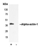 ACTA1 / Skeletal Muscle Actin Antibody - Immunoprecipitation of Alpha-actin-1 from 0.5mg Mouse Skeletal Muscle tissue lysate using 5ug of Anti-Alpha-actin-1 Antibody and 50ul of protein G magnetic beads (+). No antibody was added to the control (-). The antibody was incubated under agitation with Protein G beads for 10min Mouse Skeletal Muscle tissue lysate diluted in RIPA buffer was added to each sample and incubated for a further 10min under agitation. Proteins were eluted by addition of 40ul SDS loading buffer and incubated for 10min at 70 C; 10ul of each sample was separated on a SDS PAGE gel transferred to a nitrocellulose membrane blocked with 5% BSA and probed with Anti-Alpha-actin-1 Antibody.