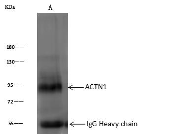 ACTA1 / Skeletal Muscle Actin Antibody - ACTN1 was immunoprecipitated using: Lane A: 0.5 mg NIH 3T3 Whole Cell Lysate. 0.5 uL anti-ACTN1 rabbit polyclonal antibody and 60 ug of Immunomagnetic beads Protein A/G. Primary antibody: Anti-ACTN1 rabbit polyclonal antibody, at 1:500 dilution. Secondary antibody: Goat Anti-Rabbit IgG (H+L)/HRP at 1/10000 dilution. Developed using the ECL technique. Performed under reducing conditions. Predicted band size: 103 kDa. Observed band size: 95 kDa.