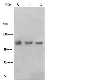 ACTA1 / Skeletal Muscle Actin Antibody - Anti-ACTN1 rabbit polyclonal antibody at 1:500 dilution. Lane A: NIH-3T3 Whole Cell Lysate. Lane B: MDA-MB-231 Whole Cell Lysate. Lane C: HeLa Whole Cell Lysate. Lane D: C6 Whole Cell Lysate. Lysates/proteins at 30 ug per lane. Secondary: Goat Anti-Rabbit IgG (H+L)/HRP at 1/10000 dilution. Developed using the ECL technique. Performed under reducing conditions. Predicted band size: 103 kDa. Observed band size: 110 kDa.