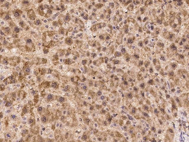 ACTA1 / Skeletal Muscle Actin Antibody - Immunochemical staining of human ACTN1 in human liver with rabbit polyclonal antibody at 1:200 dilution, formalin-fixed paraffin embedded sections.