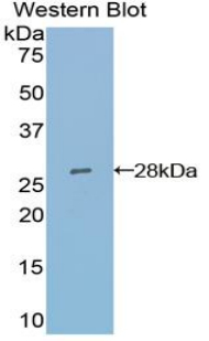 ACTA2 / Smooth Muscle Actin Antibody - Western blot of recombinant ACTA2 / Smooth Muscle Actin.