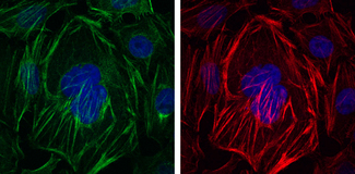 ACTA2 / Smooth Muscle Actin Antibody - Immunofluorescence of HepG2 cells using ACTA2 mouse monoclonal antibody (green). Red: Actin filaments have been labeled with Alexa Fluor-555 phalloidin. Blue: DRAQ5 fluorescent DNA dye.