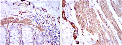 ACTA2 / Smooth Muscle Actin Antibody - IHC of paraffin-embedded human duodenum tissues (left) and human esophagus tissues (right) using ACTA2 mouse monoclonal antibody with DAB staining.