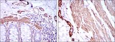 ACTA2 / Smooth Muscle Actin Antibody - IHC of paraffin-embedded human duodenum tissues (left) and human esophagus tissues (right) using ACTA2 mouse monoclonal antibody with DAB staining.