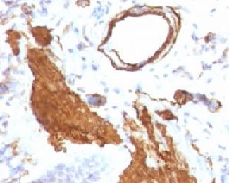 ACTA2 / Smooth Muscle Actin Antibody - Formalin-fixed, paraffin-embedded rat lung stained with alpha Smooth Muscle Actin antibody (ACTA2/791).  This image was taken for the unmodified form of this product. Other forms have not been tested.