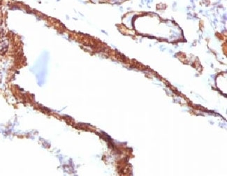 ACTA2 / Smooth Muscle Actin Antibody - IHC testing of FFPE rat lung with Smooth Muscle Actin antibody (clone SMAT2-1).  This image was taken for the unmodified form of this product. Other forms have not been tested.