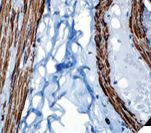 ACTA2 / Smooth Muscle Actin Antibody - IHC of Actin, Smooth-Muscle on FFPE Appendix tissue.